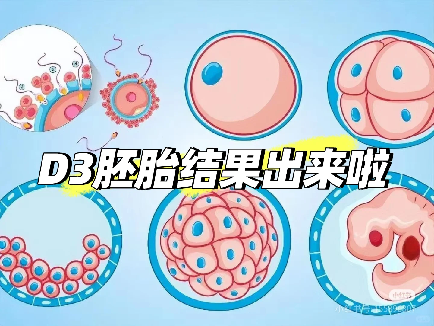 11.13取卵19个,当天最多。,国内代生要多少钱_国内代生供卵费用